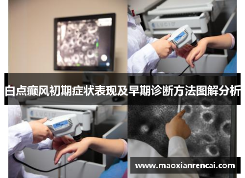 白点癫风初期症状表现及早期诊断方法图解分析 白点癫风初期症状表现及早期诊断方法图解分析